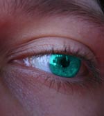 Fotografia po obr�bce